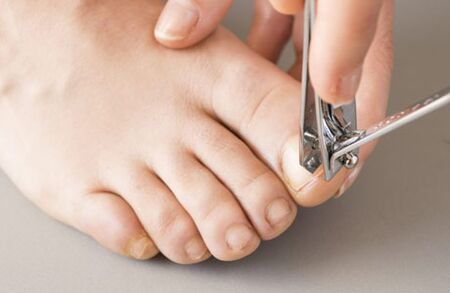 The causes of the fungus on the nails