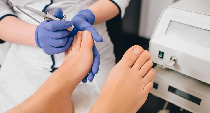 professional treatment for toenail fungus