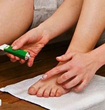 The use of therapeutic ointment for the defeat of the nail of the big toe with a fungus