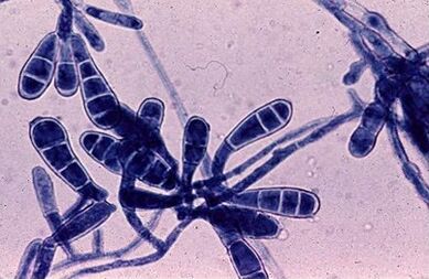 Bacteria causing nail mushrooms